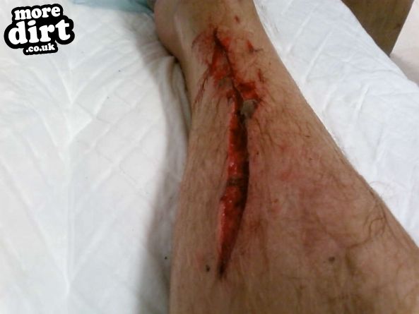 Black Trail - Coed Llandegla Forest