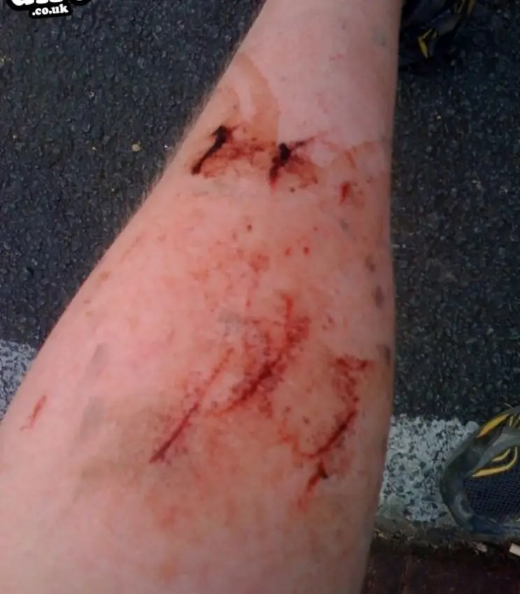 slipped off pedals... was painful!