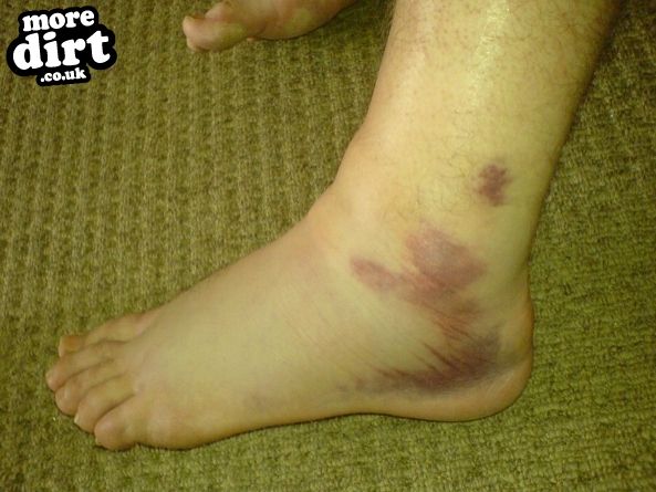 Okeford Hill Mountain Bike Park