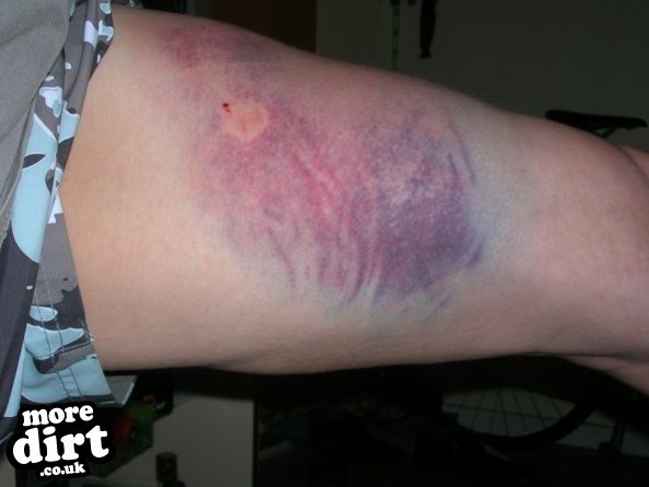 lost the front end (trying) landing at step up. 