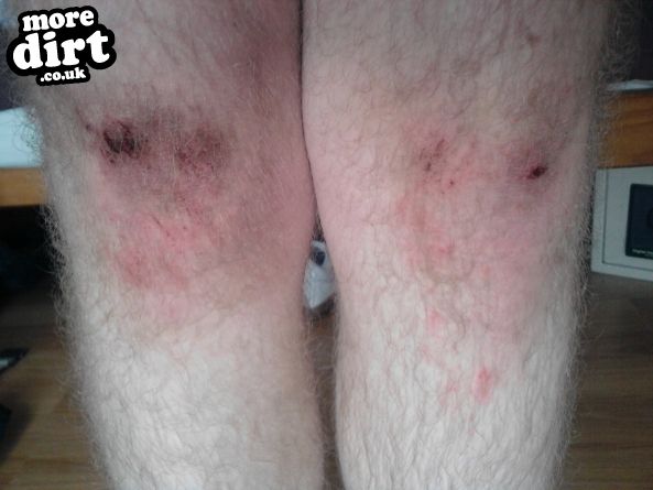 Outside Line Trail - Chopwell