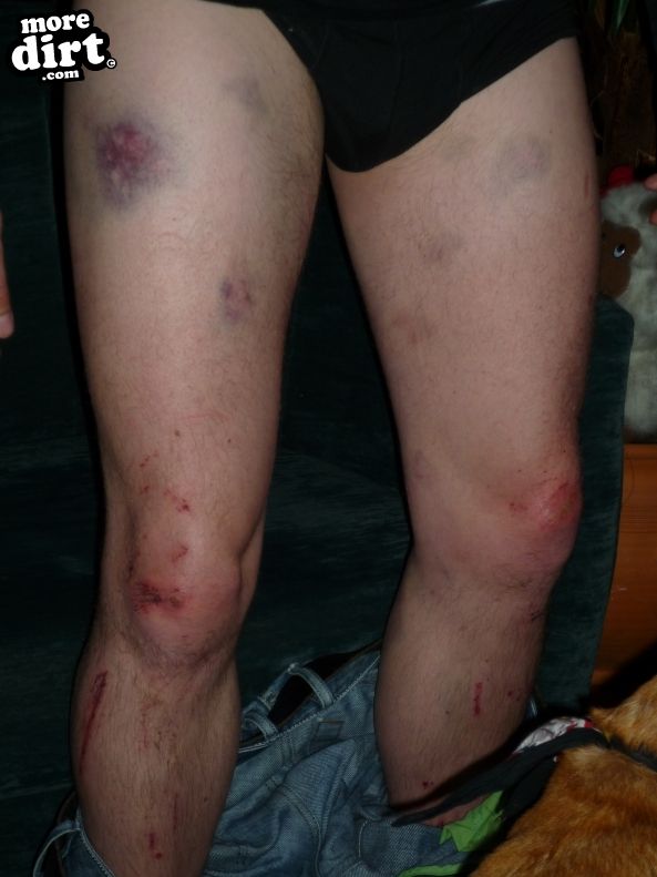 Nick realized that the shin pad he had been laughi