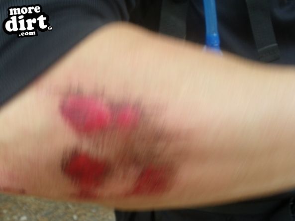 Delamere Forest Mountain Bike Trails