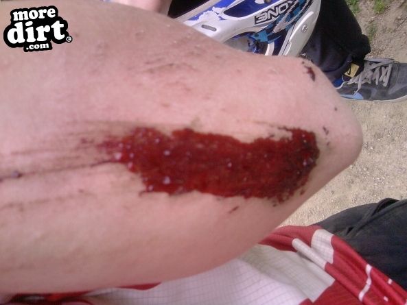 Powerline Trail - Chopwell