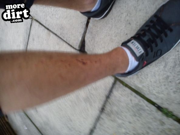 No other injuries apart from the graize on my elbo