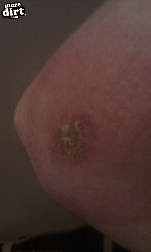 Hamsterley Forest Mountain Bike Trails