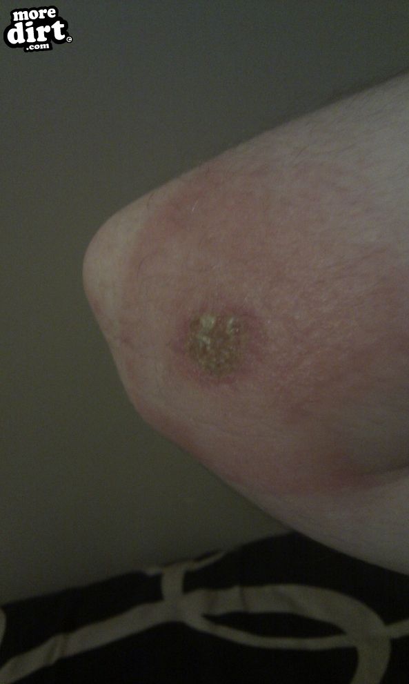 Hamsterley Forest Mountain Bike Trails