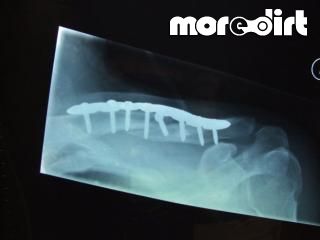 Poldice Valley Trails