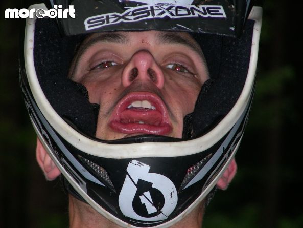 Chicksands Bike Park