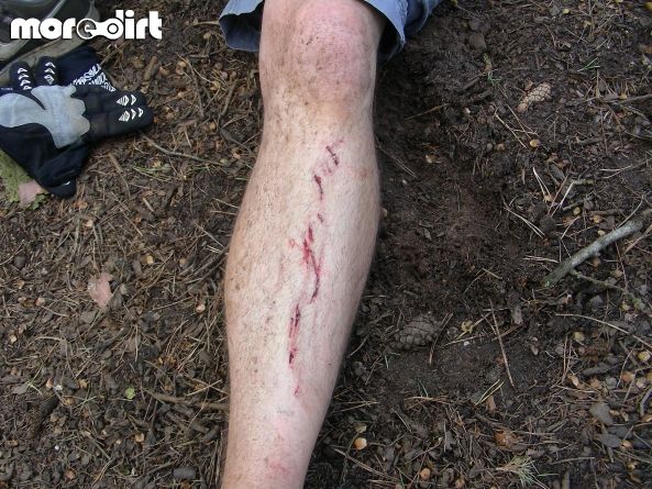 Chicksands Bike Park