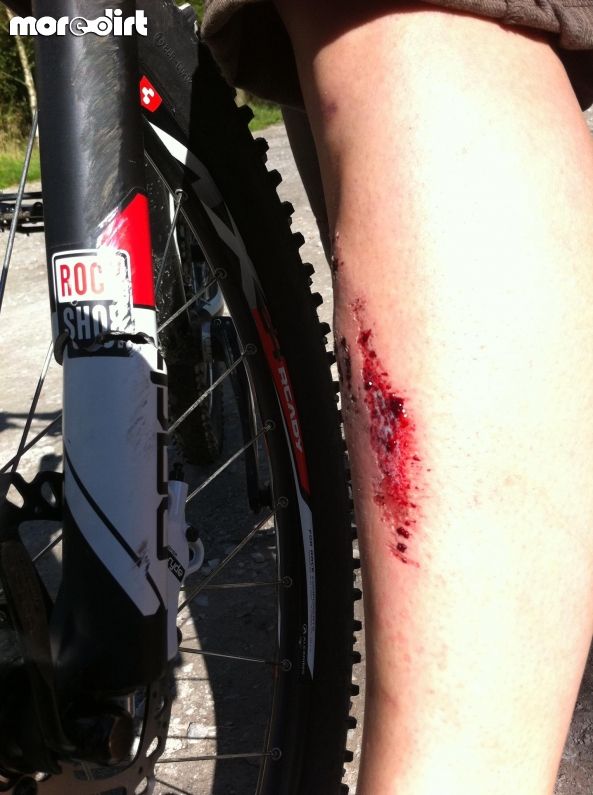 Gisburn Forest Mountain Bike Trails