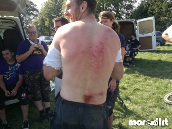 Moelfre Downhill Mountain Bike Track