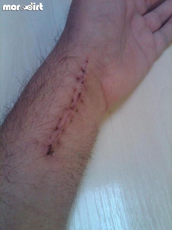 Black Trail - Coed Llandegla Forest