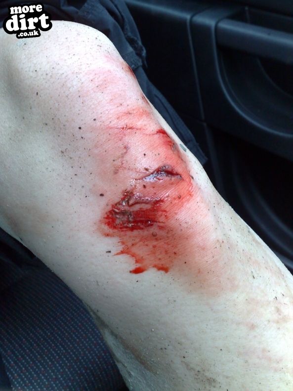 Gorlech Trail - Brechfa