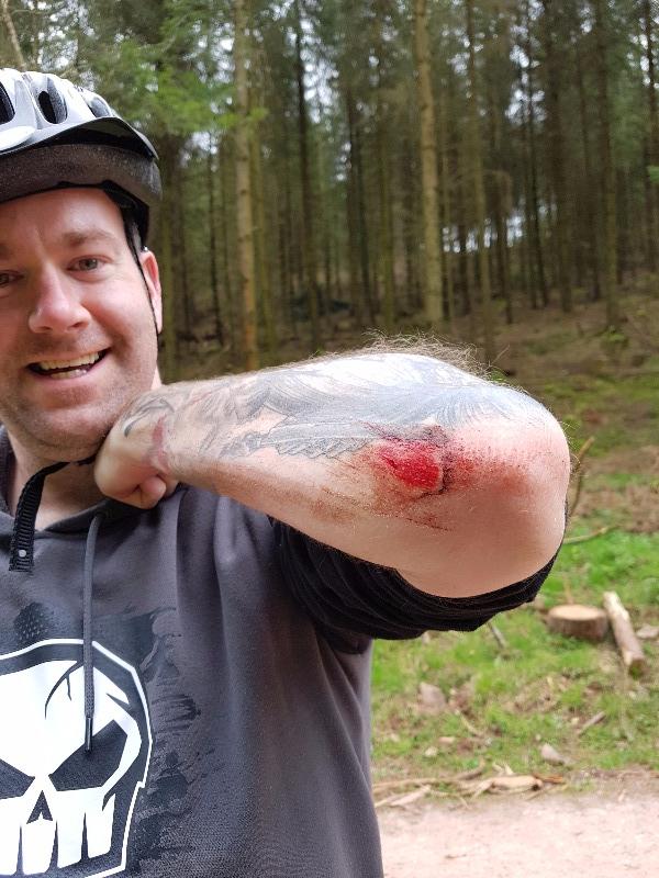 Triscombe Mountain Bike Trails