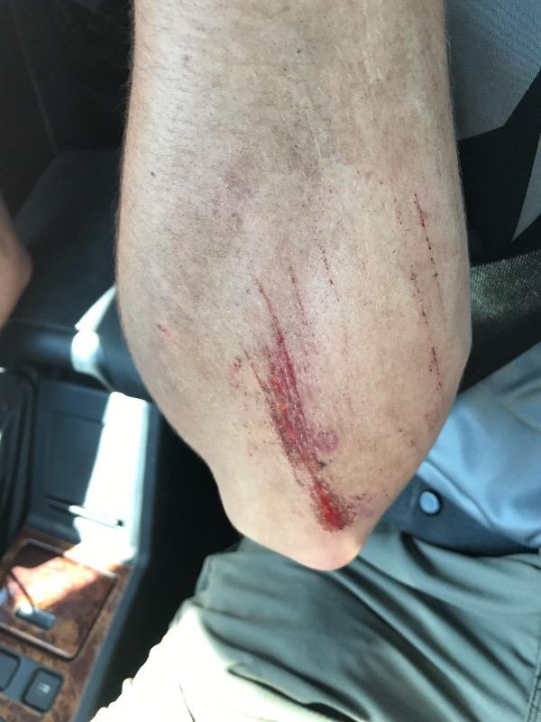 Swinley Forest Mountain Bike Centre