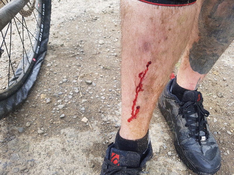 417 Mountain Bike Park